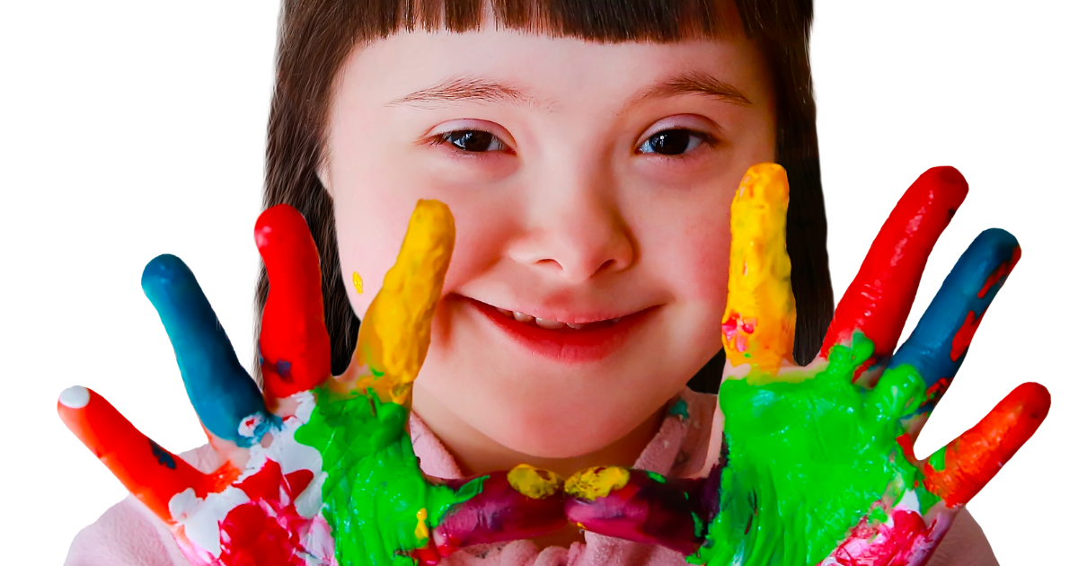 La trisomie 21 ou syndrome de Down